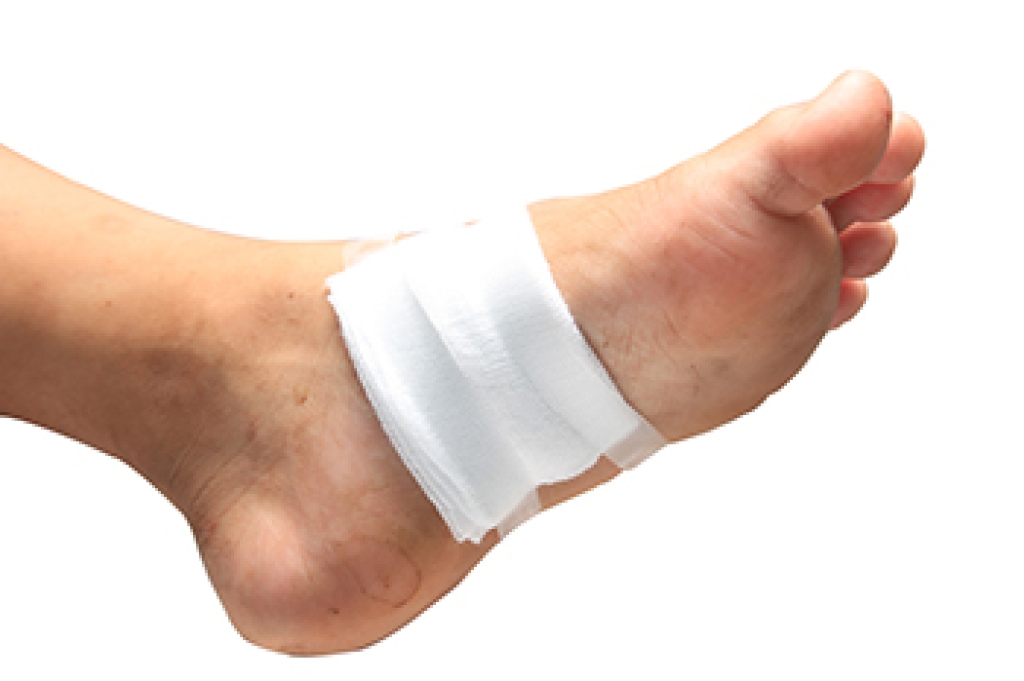 Foot Pressure Sores Can Lead to Serious Complications