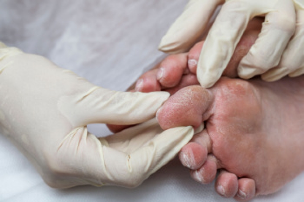 Facts About Diabetic Limb Salvage