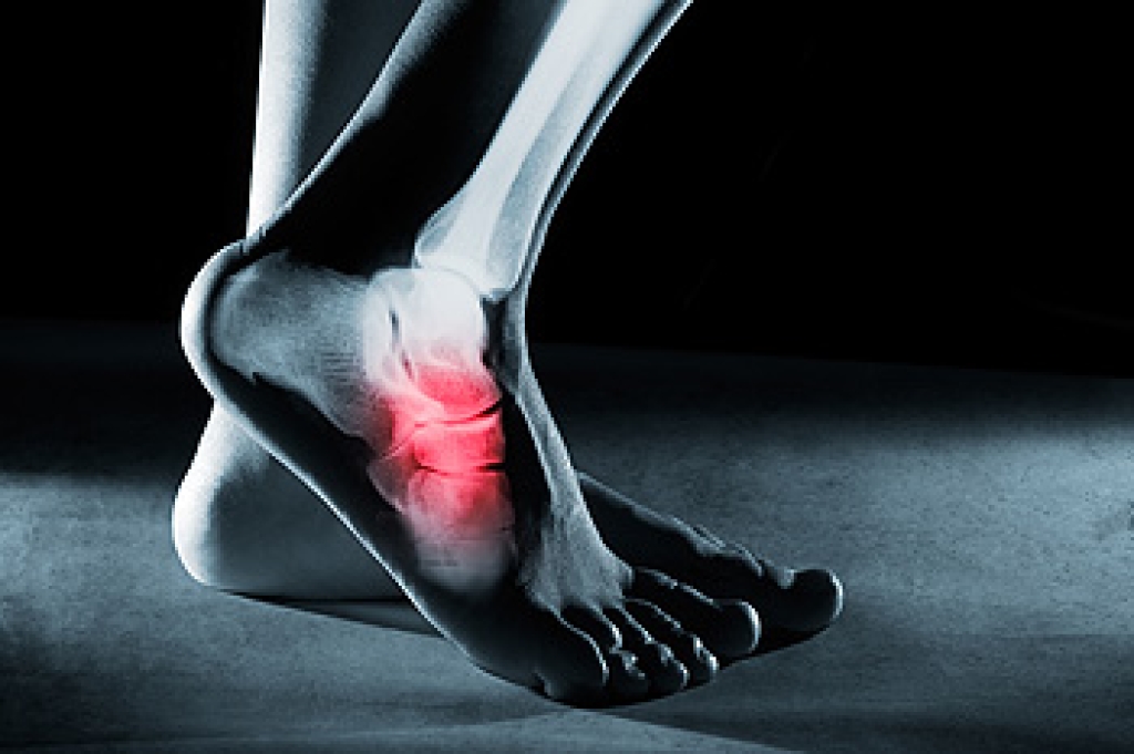 Symptoms of Foot Stress Fractures