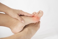 Who Is Most at Risk to Develop Bunions