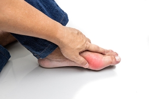 How a Podiatrist Can Help Manage Gout